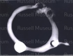 Photo: X-ray of leg iron, found Russell waterfront, 1995; 99/169 Photo: X-ray of leg iron, found Russell waterfront, 1995; 99/169