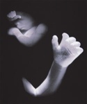 Hand Fetus; Norton, Karen Lavallee; undated; 2011:0007:0003
