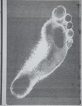 Foot; Sheridan, Sonia Landy; 1973; 1981:0117:0002