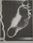 Foot; Sheridan, Sonia Landy; 1973; 1981:0117:0019