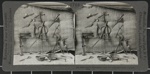 Stereograph of Surgical Instruments In A Physician's Home; Underwood & Underwood; circa 1897; 1977:0013:0010 