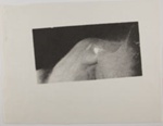 Untitled [Curved abstract shapes]; Edelstein, David; undated; 1978:0144:0003