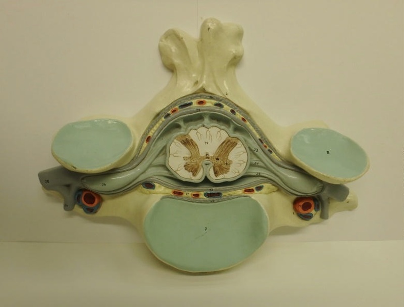 Equipment: Model of Cross Section of Spinal Cord; Ca 1949-1990; AR#9436 ...