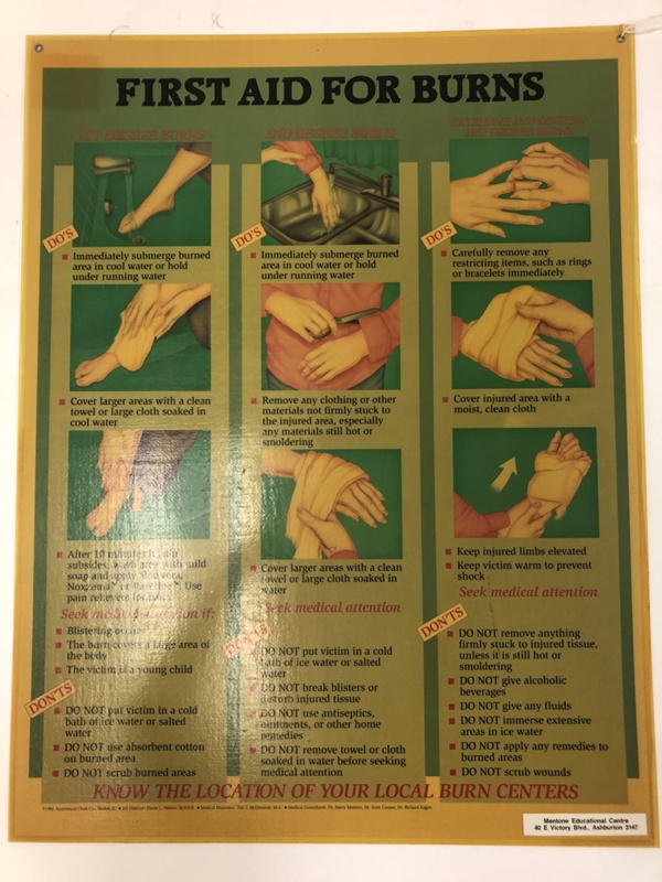 Poster: First Aid for Burns; 1988; AR#3474 | eHive