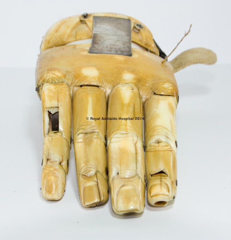 Equipment:  Corporal Coles Prosthetic Hand; Robert Norman; 1845; AR#1723