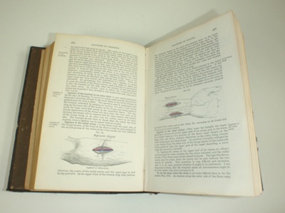 Book: A Manual for the Practice of Surgery - Volumes 1 & 2; 1879; AR#5126