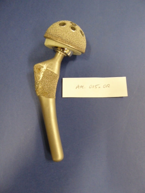 Porous Coated TCA Hip Replacement (1980s); AM.015.OR eHive