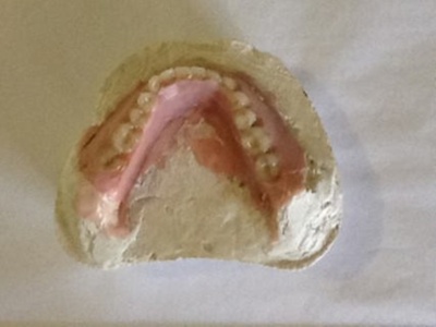 False tooth mould; Bloomfield Hospital; 1938-1950; BC2015/44