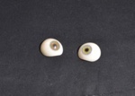 Ocular Prosthesis; Hansens Optometry; CH22/007