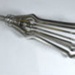 Plated Steel Adjustable Cervical Dilator; 1900s; 1990.202